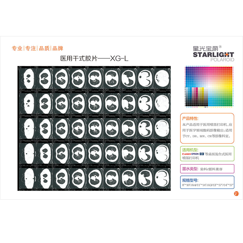医用干式胶片-XG-L MedicalDryFilmXG-L